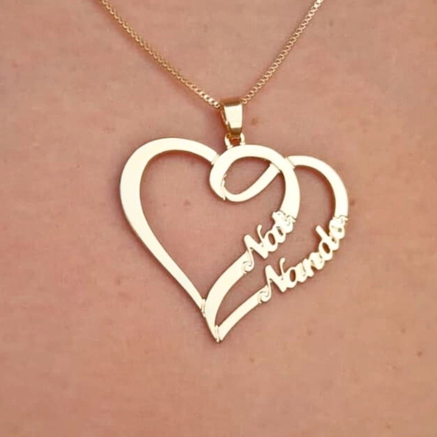 Peças Personalizadas